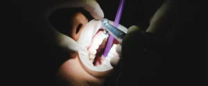 Paciente al que se le está realizando tratamiento de diseño de sonrisa