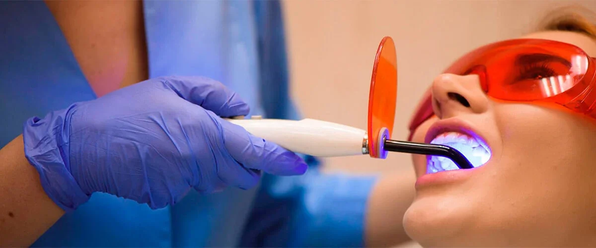 Cuánto dura un blanqueamiento dental